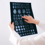 Doctor looking at an MRI while explaining effects of alcohol on the brain.