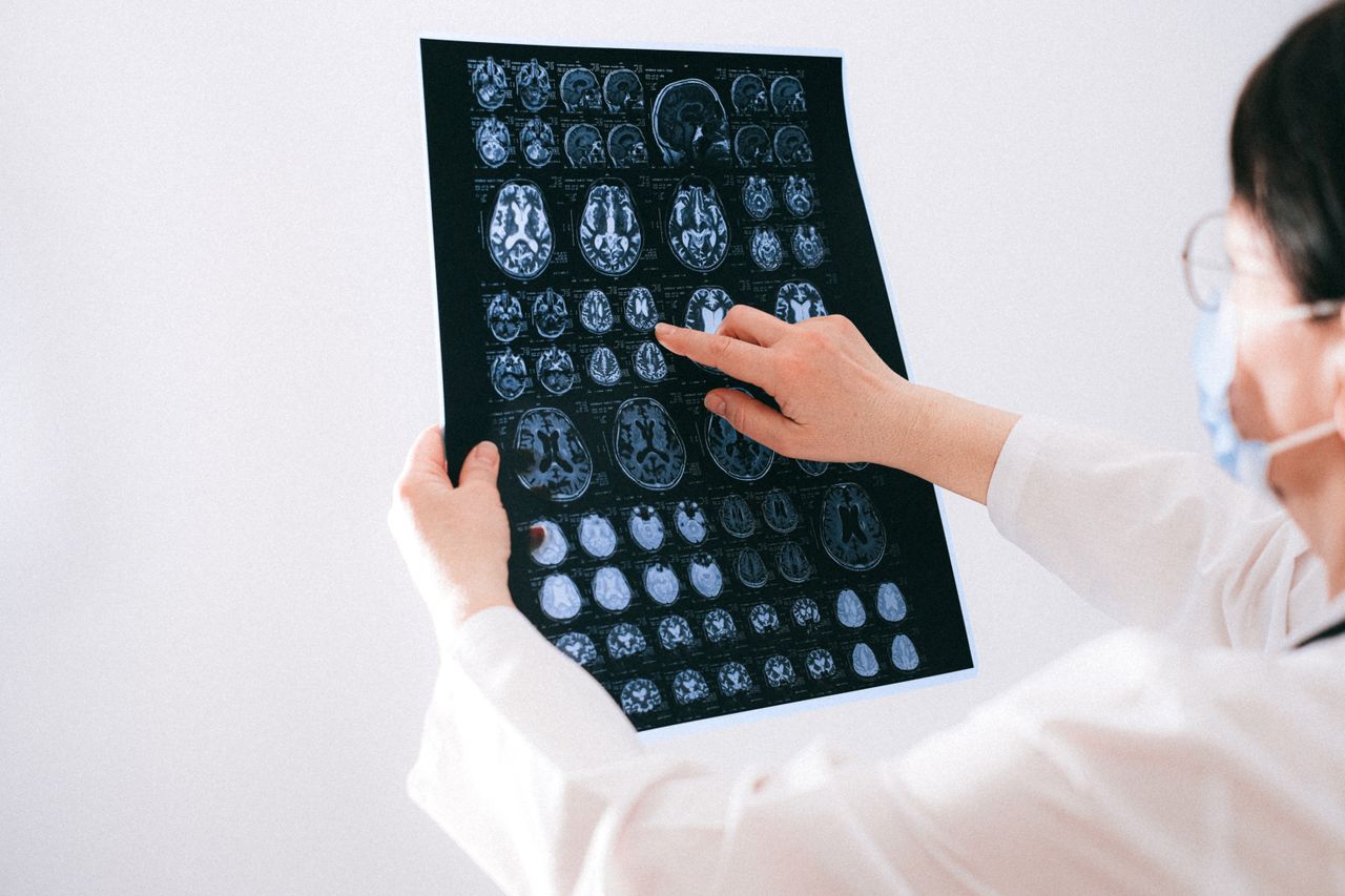 Doctor looking at an MRI while explaining effects of alcohol on the brain.