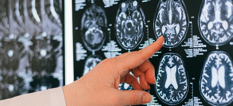doctor pointing at a brain image