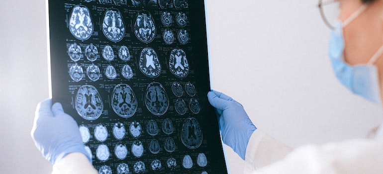 woman holding up an MRI of a person's brain