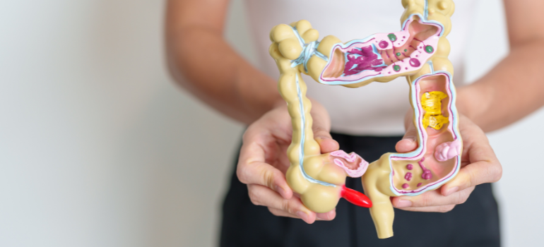 A woman holds a model of the digestive system.