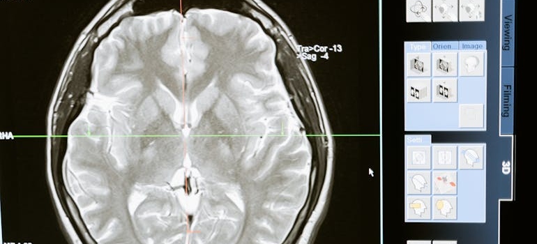 MRI of a brain.