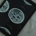 Brain scan imaging on a tablet.