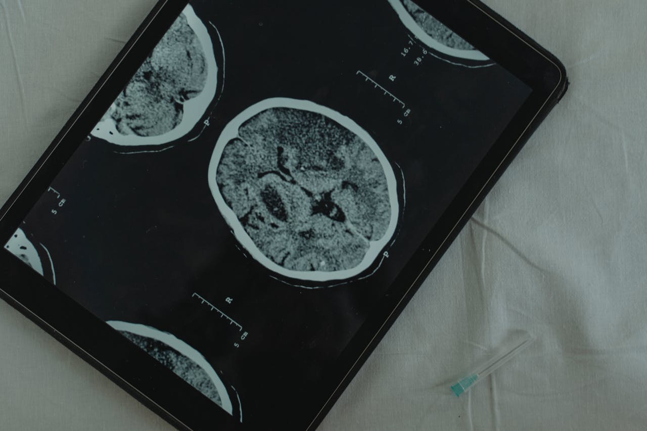 Brain scan imaging on a tablet.